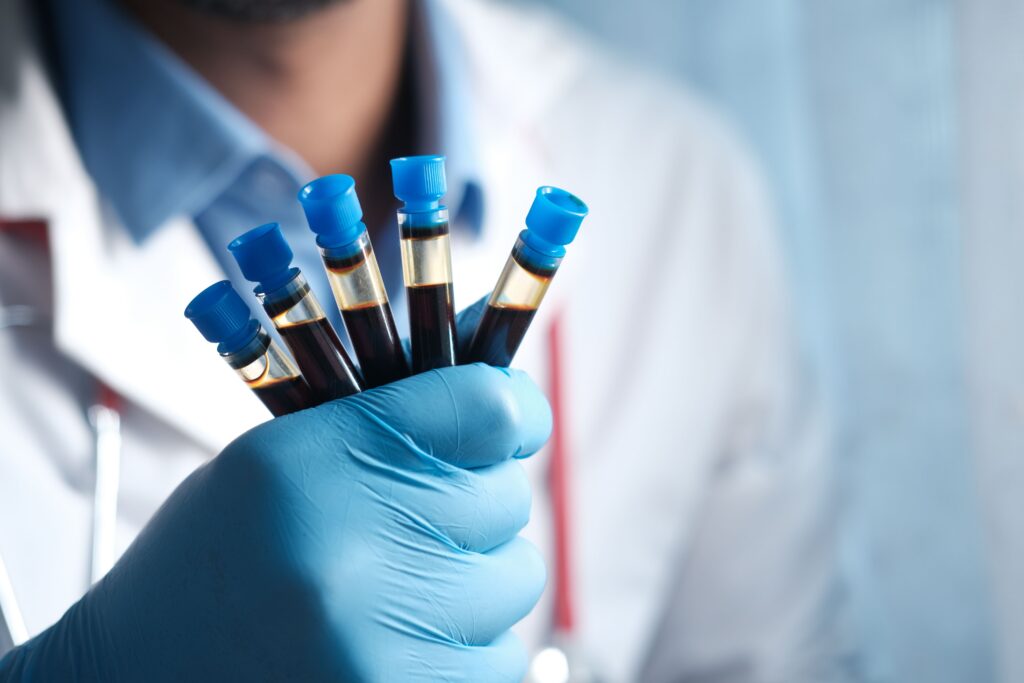 Testosterone and cholesterol: gloved hand holding blood sample tubes for lipid panel and hormone testing