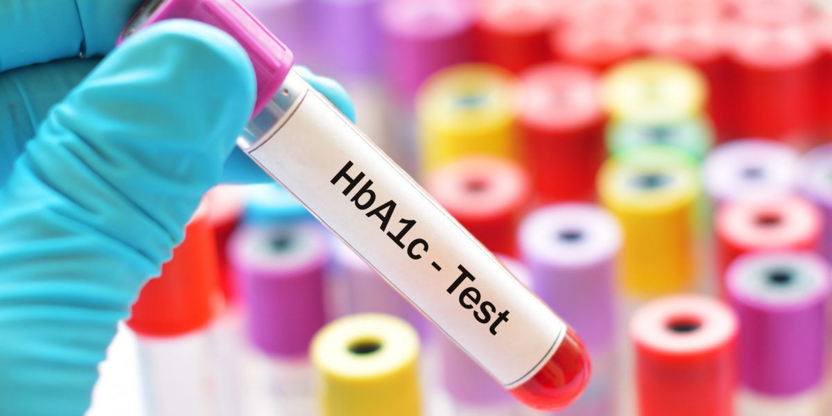 Blood sample for metabolic and hormone lab testing, representing comprehensive blood work